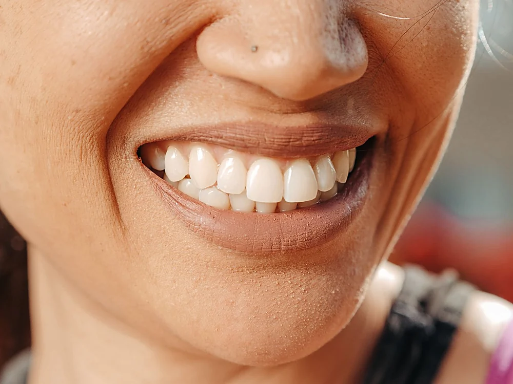 A close-up of a wide, natural smile