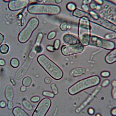 Gut bacteria seen under a microscope